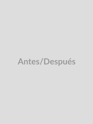 Before - María González